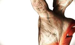 Tens�o ou dor muscular? Pode ser a f�scia!